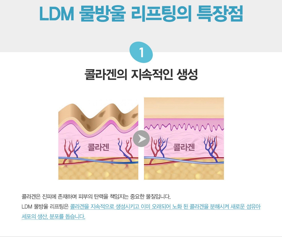 LDM2